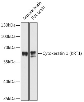 Cytokeratin 1 (KRT1) Rabbit Polyclonal Antibody