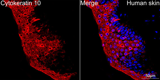 Cytokeratin 10 Rabbit Monoclonal Antibody