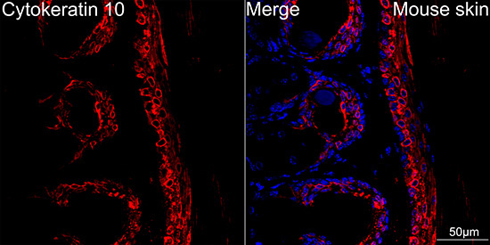 Cytokeratin 10 Rabbit Monoclonal Antibody - Image 2