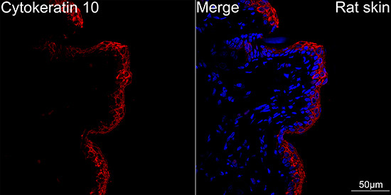 Cytokeratin 10 Rabbit Monoclonal Antibody - Image 3