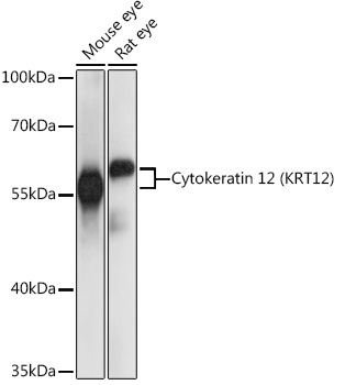 Cytokeratin 12 (KRT12) Rabbit Polyclonal Antibody