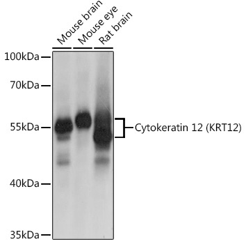 Cytokeratin 12 (KRT12) Rabbit Polyclonal Antibody