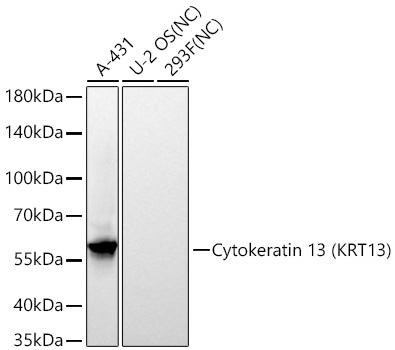 Cytokeratin 13 (KRT13) Rabbit Monoclonal Antibody