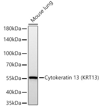 Cytokeratin 13 (KRT13) Rabbit Monoclonal Antibody - Image 2