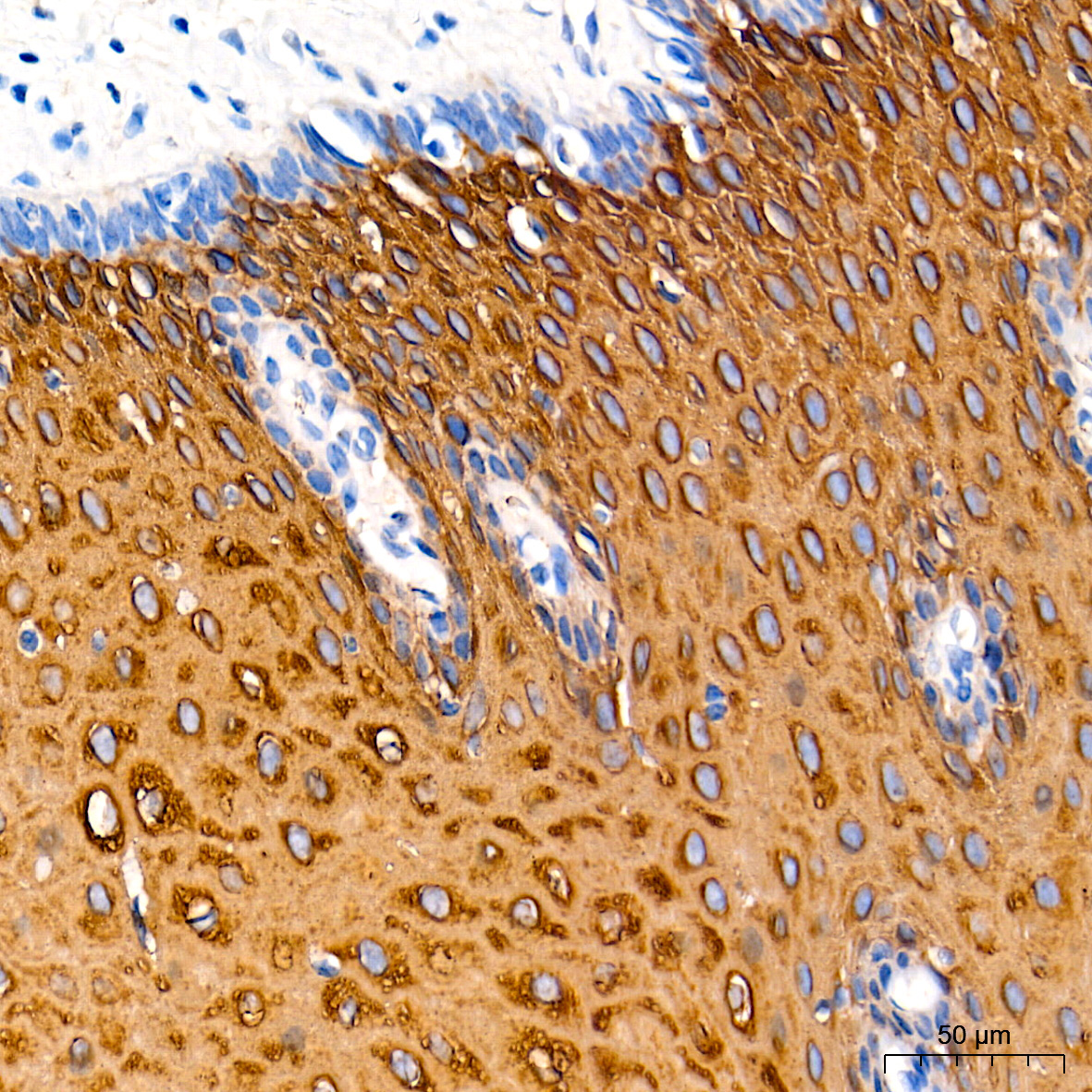 Cytokeratin 13 (KRT13) Rabbit Monoclonal Antibody - Image 3