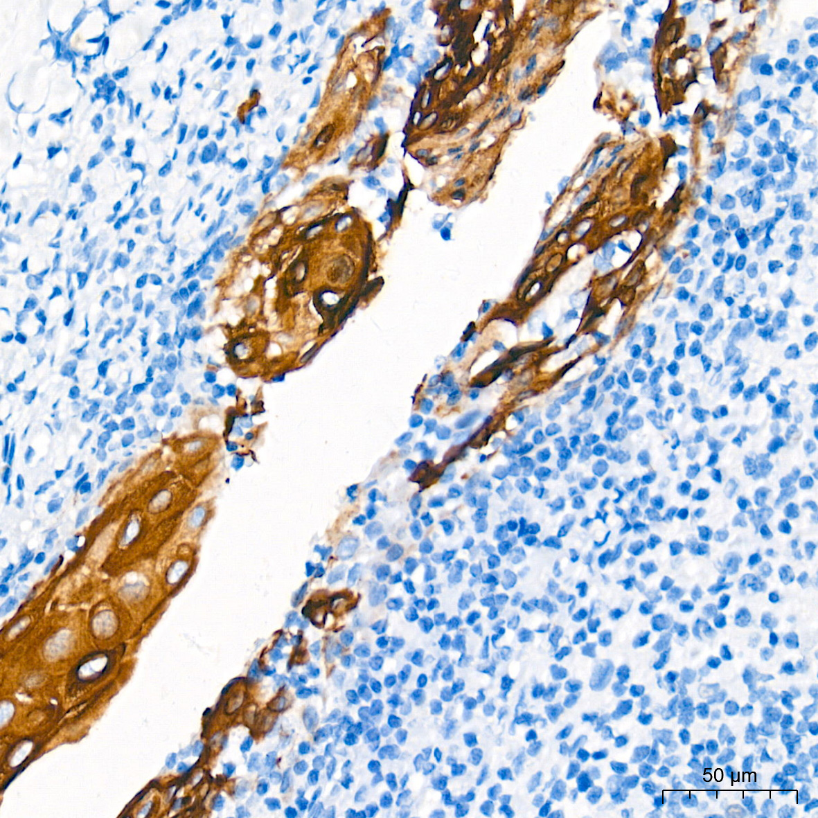 Cytokeratin 13 (KRT13) Rabbit Monoclonal Antibody - Image 4