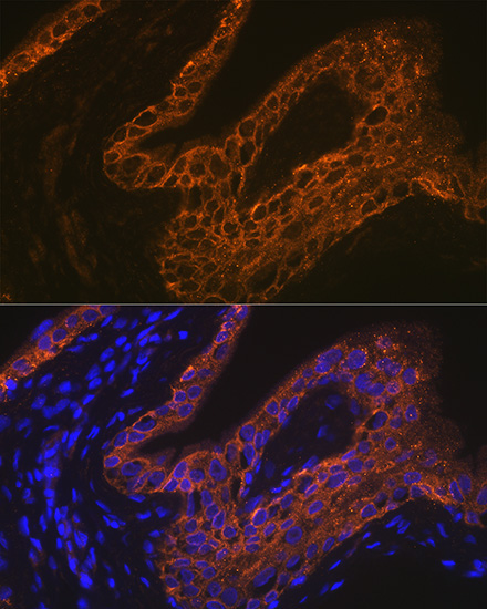 Cytokeratin 13 (KRT13) Rabbit Monoclonal Antibody - Image 5