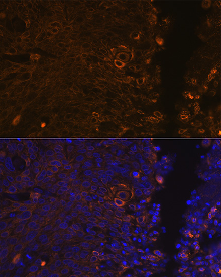Cytokeratin 13 (KRT13) Rabbit Monoclonal Antibody - Image 6