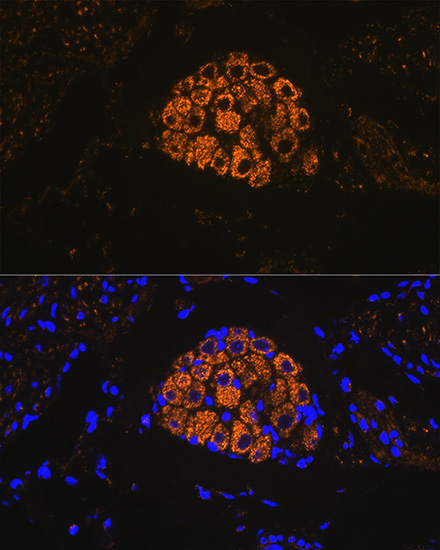 Cytokeratin 13 (KRT13) Rabbit Monoclonal Antibody - Image 7