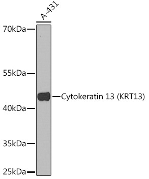 Cytokeratin 13 (KRT13) Rabbit Polyclonal Antibody