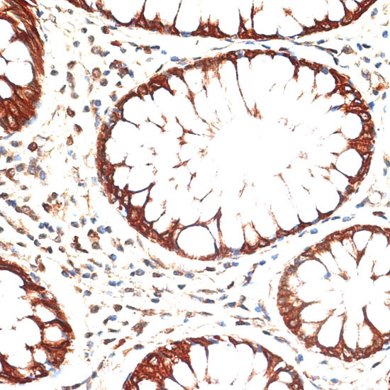 Cytokeratin 13 (KRT13) Rabbit Polyclonal Antibody - Image 2