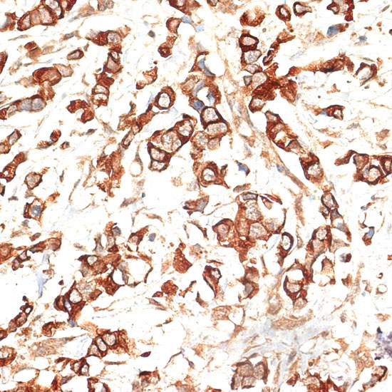 Cytokeratin 13 (KRT13) Rabbit Polyclonal Antibody - Image 3