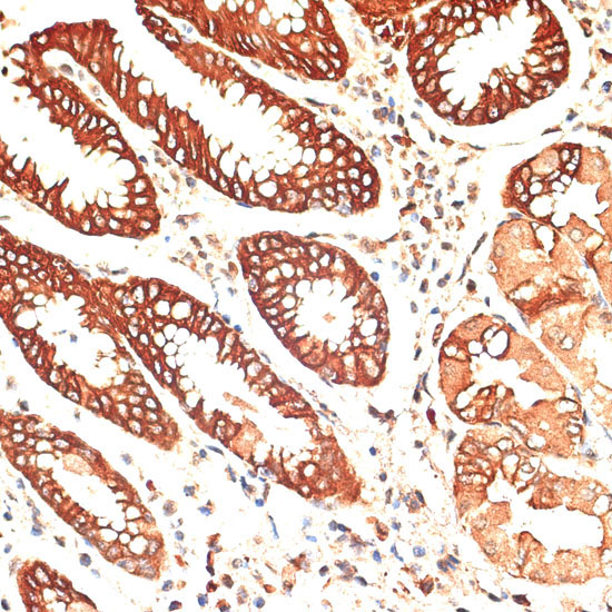 Cytokeratin 13 (KRT13) Rabbit Polyclonal Antibody - Image 4