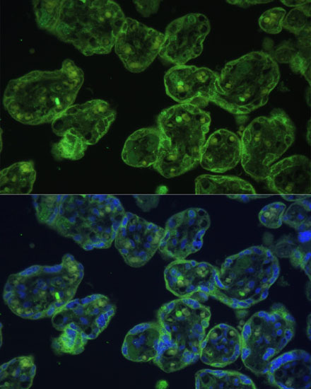 Cytokeratin 13 (KRT13) Rabbit Polyclonal Antibody - Image 5