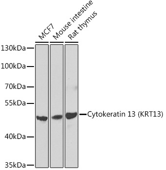 Cytokeratin 13 (KRT13) Rabbit Polyclonal Antibody