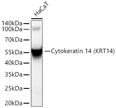 Cytokeratin 14 (KRT14) Rabbit Monoclonal Antibody