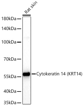 Cytokeratin 14 (KRT14) Rabbit Monoclonal Antibody - Image 2
