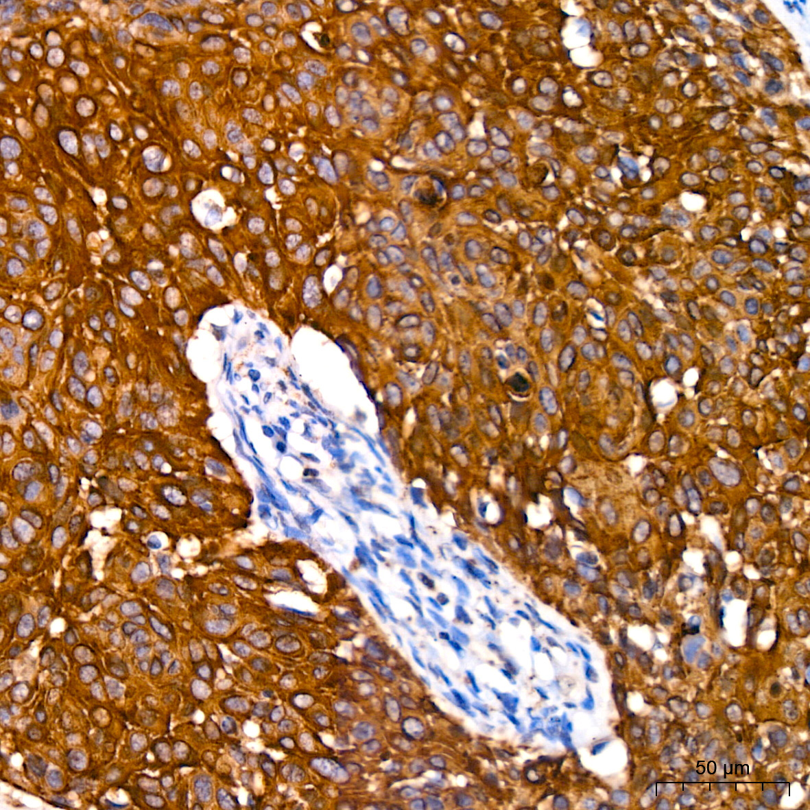 Cytokeratin 14 (KRT14) Rabbit Monoclonal Antibody - Image 3