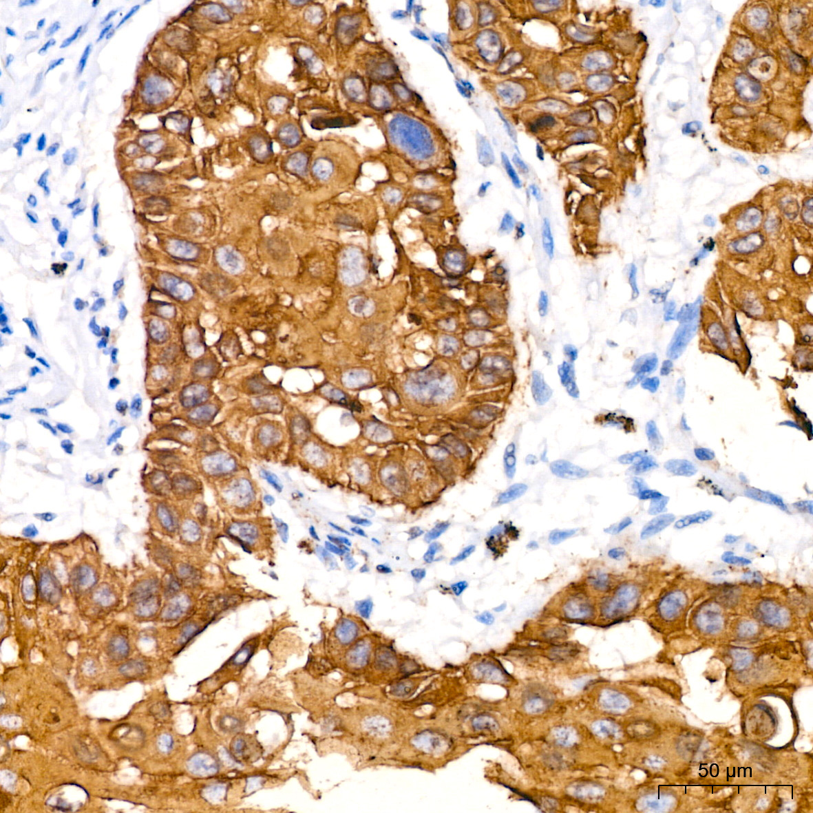 Cytokeratin 14 (KRT14) Rabbit Monoclonal Antibody - Image 4