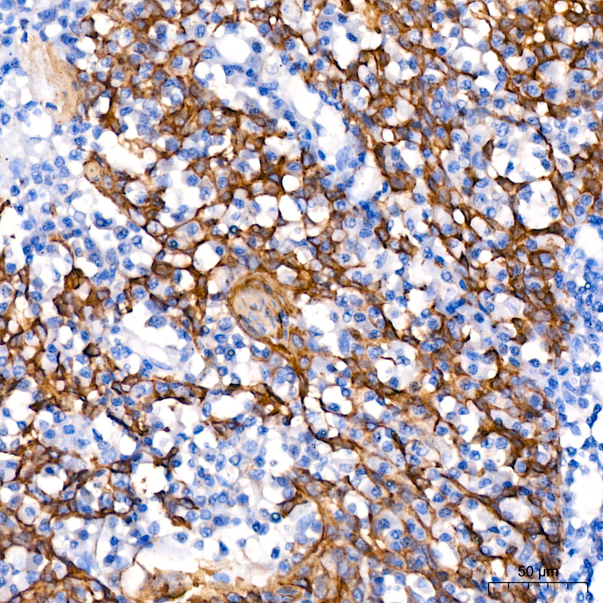 Cytokeratin 14 (KRT14) Rabbit Monoclonal Antibody - Image 5