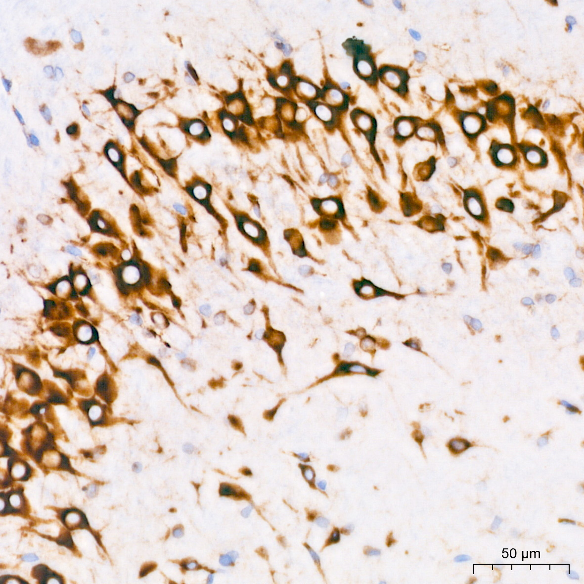 Cytokeratin 14 (KRT14) Rabbit Monoclonal Antibody - Image 6