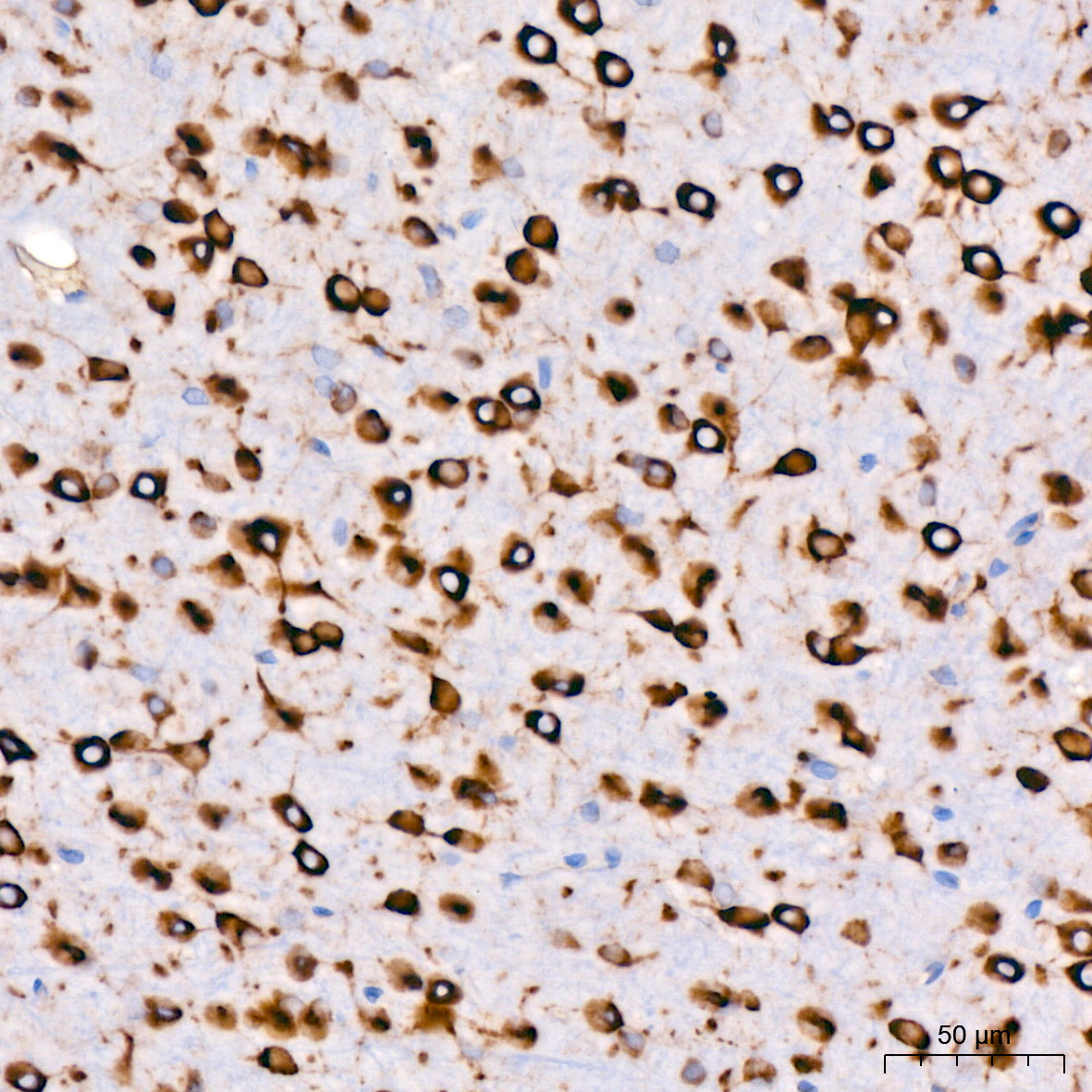 Cytokeratin 14 (KRT14) Rabbit Monoclonal Antibody - Image 7
