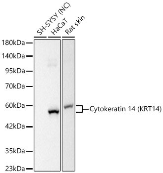 Cytokeratin 14 (KRT14) Rabbit Monoclonal Antibody