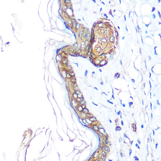 Cytokeratin 14 (KRT14) Rabbit Polyclonal Antibody - Image 2