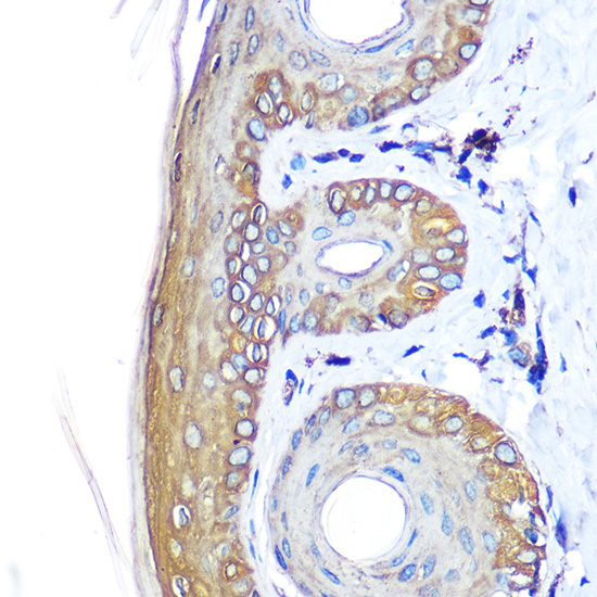 Cytokeratin 14 (KRT14) Rabbit Polyclonal Antibody - Image 3