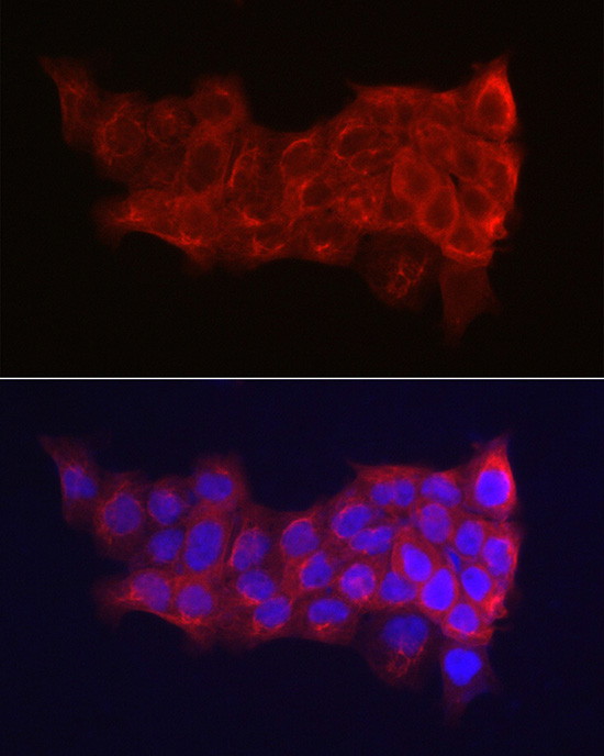 Cytokeratin 14 (KRT14) Rabbit Polyclonal Antibody - Image 4