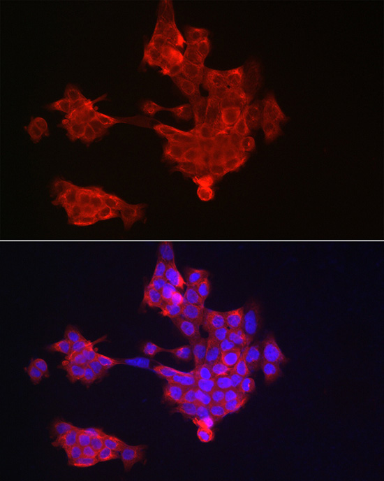Cytokeratin 14 (KRT14) Rabbit Polyclonal Antibody - Image 5