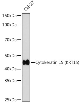 Cytokeratin 15 (KRT15) Rabbit Monoclonal Antibody