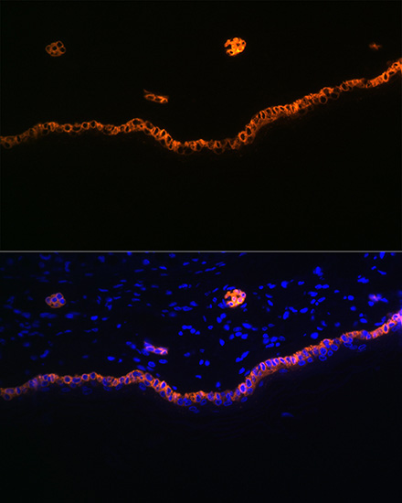 Cytokeratin 15 (KRT15) Rabbit Monoclonal Antibody - Image 2
