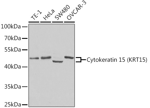 Cytokeratin 15 (KRT15) Rabbit Polyclonal Antibody