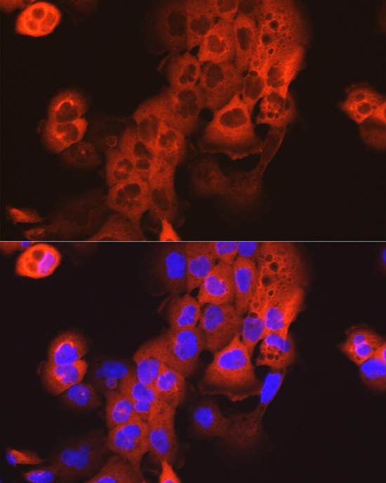 Cytokeratin 15 (KRT15) Rabbit Polyclonal Antibody - Image 2