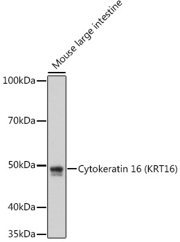 Cytokeratin 16 (KRT16) Rabbit Monoclonal Antibody
