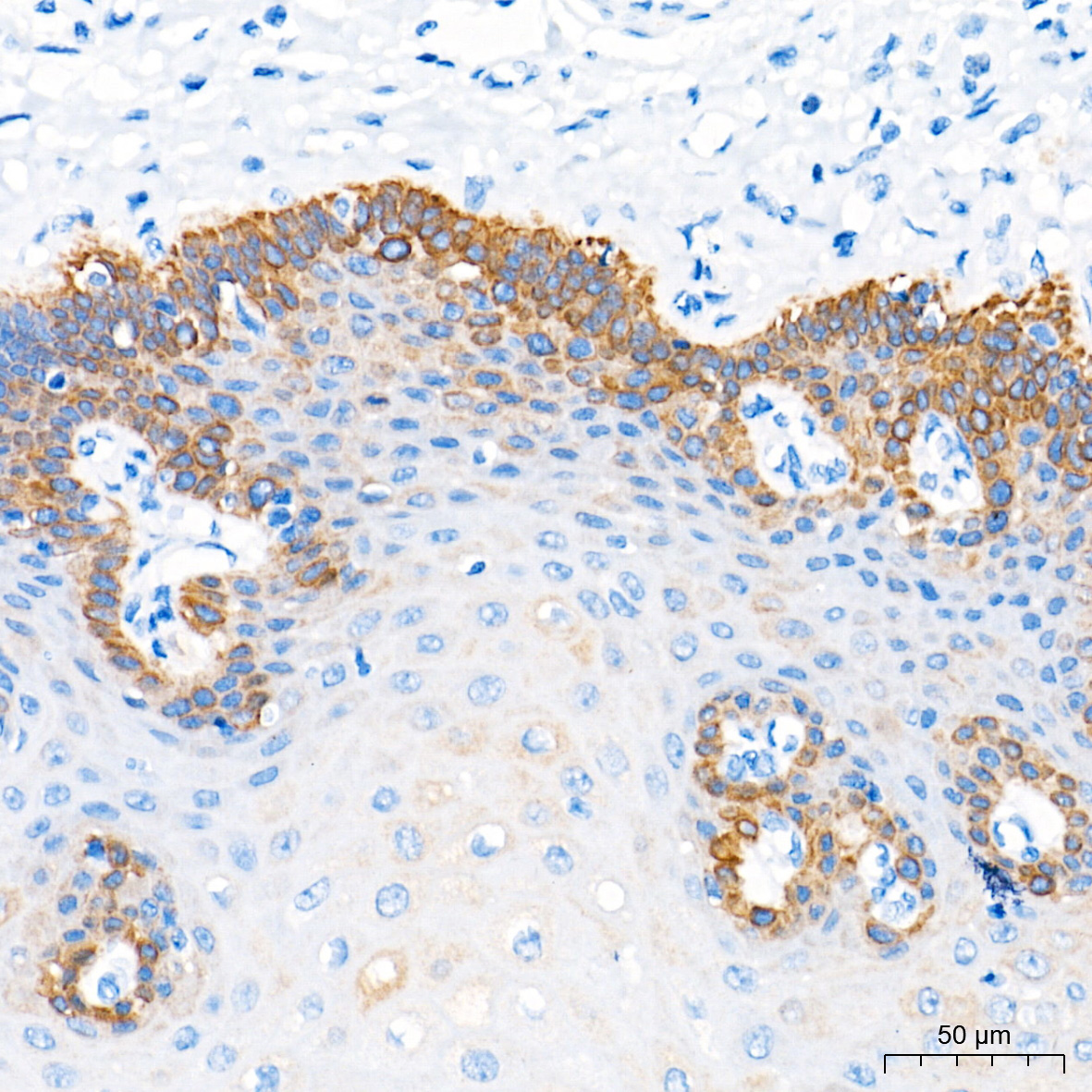 Cytokeratin 16 (KRT16) Rabbit Monoclonal Antibody - Image 2