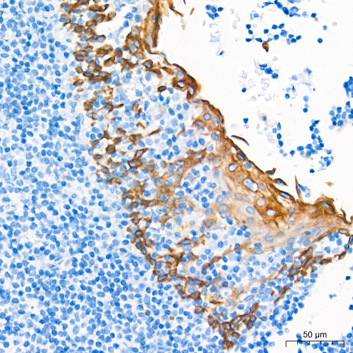 Cytokeratin 16 (KRT16) Rabbit Monoclonal Antibody - Image 3