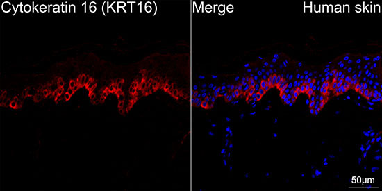 Cytokeratin 16 (KRT16) Rabbit Monoclonal Antibody - Image 4