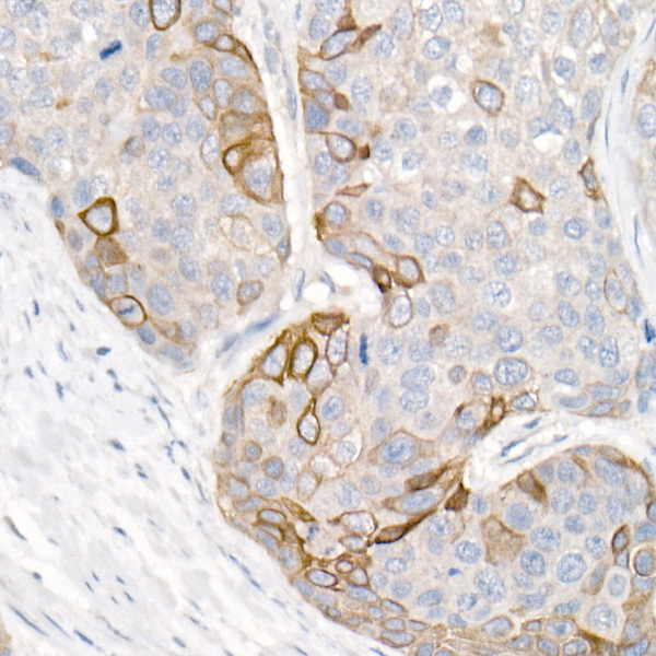 Cytokeratin 16 (KRT16) Rabbit Polyclonal Antibody - Image 2