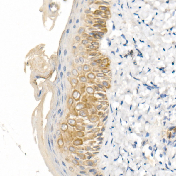 Cytokeratin 16 (KRT16) Rabbit Polyclonal Antibody - Image 3