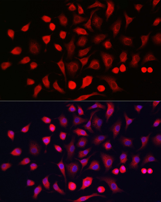Cytokeratin 16 (KRT16) Rabbit Polyclonal Antibody - Image 4