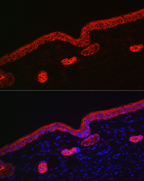 Cytokeratin 16 (KRT16) Rabbit Polyclonal Antibody - Image 5