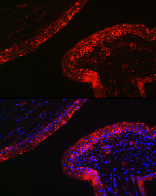 Cytokeratin 16 (KRT16) Rabbit Polyclonal Antibody - Image 6