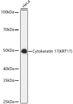 Cytokeratin 17 (KRT17) Rabbit Monoclonal Antibody