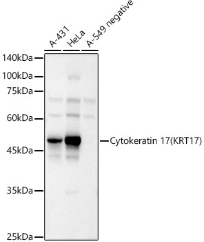 Cytokeratin 17 (KRT17) Rabbit Polyclonal Antibody