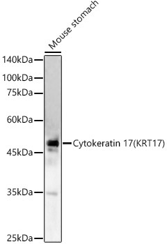 Cytokeratin 17 (KRT17) Rabbit Polyclonal Antibody - Image 2
