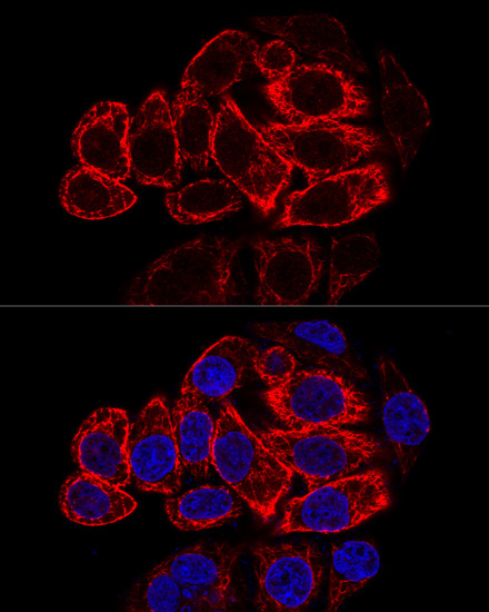 Cytokeratin 17 (KRT17) Rabbit Polyclonal Antibody - Image 3