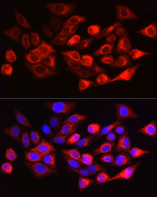 Cytokeratin 17 (KRT17) Rabbit Polyclonal Antibody - Image 4