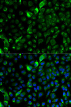 Cytokeratin 17 (KRT17) Rabbit Polyclonal Antibody - Image 2